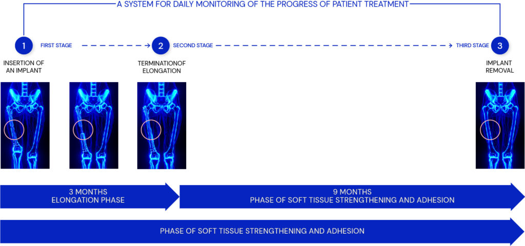 Treatment process